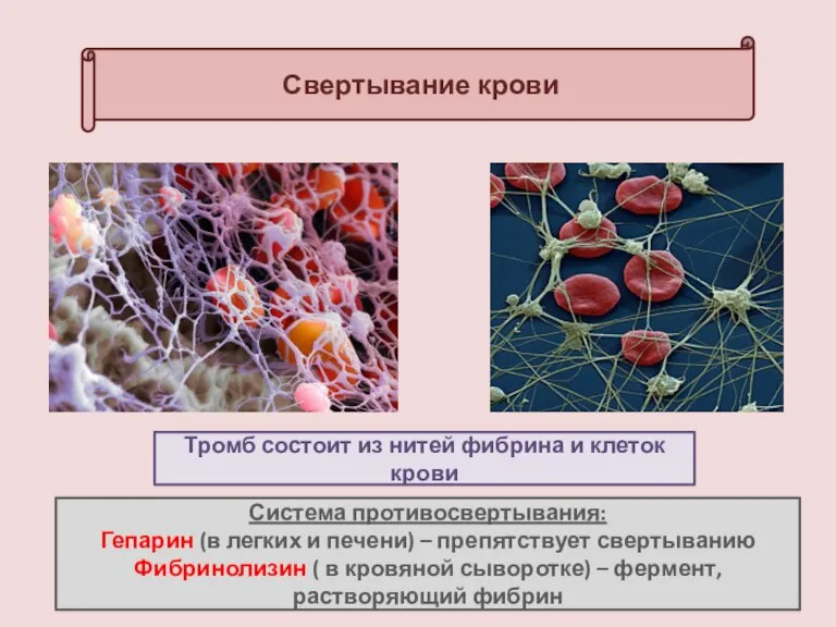 Свертывание крови Тромб состоит из нитей фибрина и клеток крови Система противосвертывания: