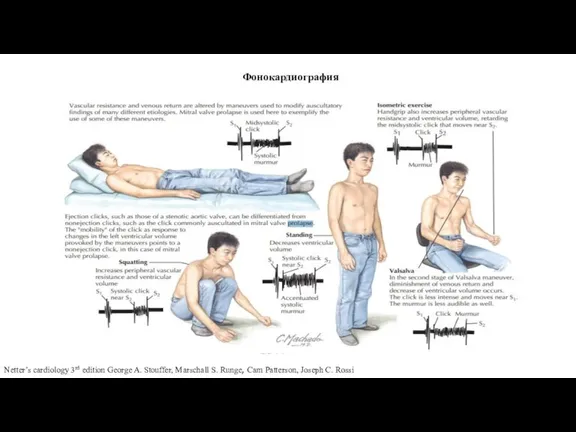 Фонокардиография Netter’s cardiology 3rd edition George A. Stouffer, Marschall S. Runge, Cam Patterson, Joseph C. Rossi