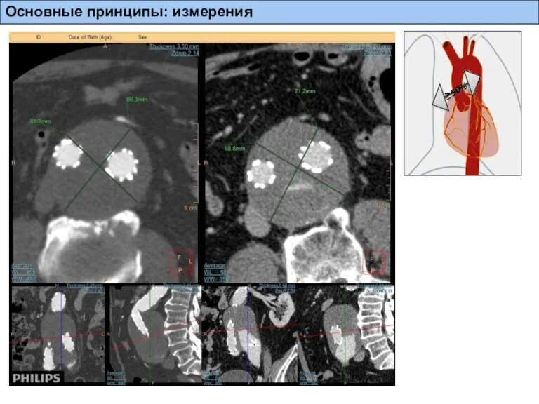 Основные принципы: измерения