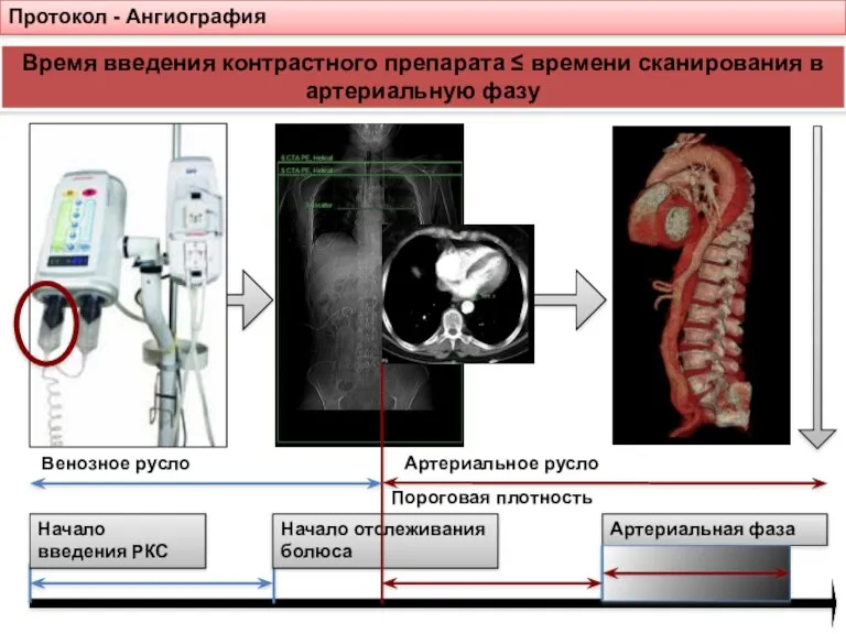 Протокол - Ангиография Время введения контрастного препарата ≤ времени сканирования в артериальную