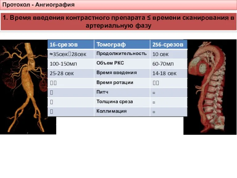 Протокол - Ангиография 1. Время введения контрастного препарата ≤ времени сканирования в артериальную фазу