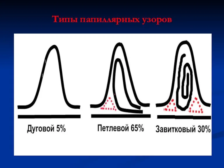 Типы папиллярных узоров