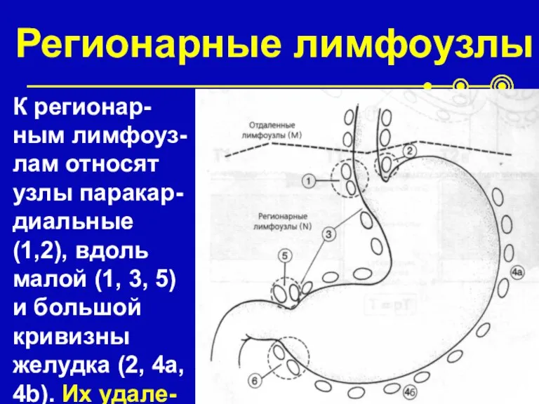 Регионарные лимфоузлы К регионар-ным лимфоуз-лам относят узлы паракар-диальные (1,2), вдоль малой (1,