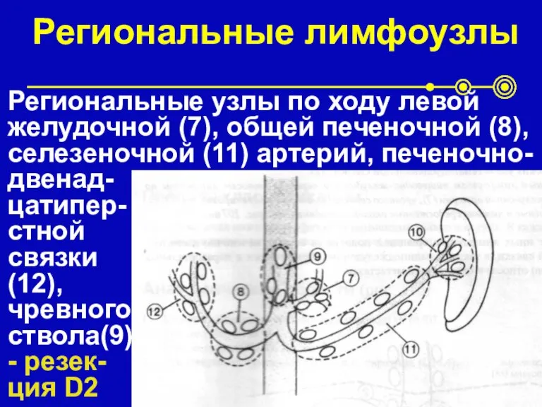 Региональные лимфоузлы Региональные узлы по ходу левой желудочной (7), общей печеночной (8),