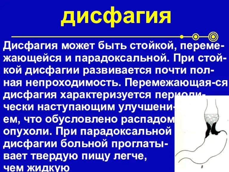 дисфагия Дисфагия может быть стойкой, переме-жающейся и парадоксальной. При стой-кой дисфагии развивается