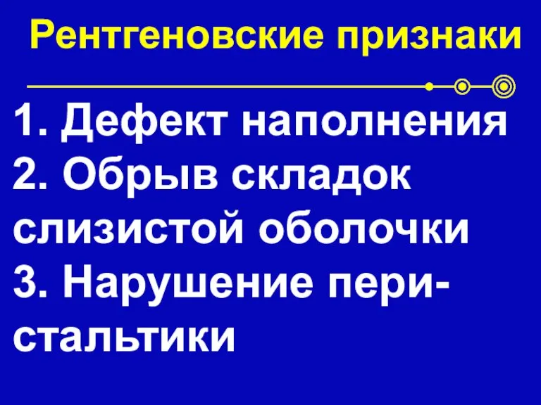 Рентгеновские признаки 1. Дефект наполнения 2. Обрыв складок слизистой оболочки 3. Нарушение пери-стальтики