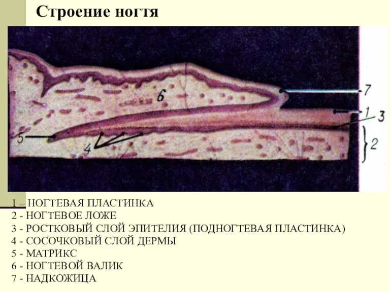 Строение ногтя 1 – НОГТЕВАЯ ПЛАСТИНКА 2 - НОГТЕВОЕ ЛОЖЕ 3 -