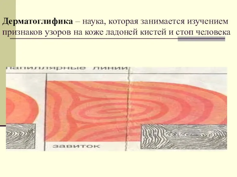 Дерматоглифика – наука, которая занимается изучением признаков узоров на коже ладоней кистей и стоп человека