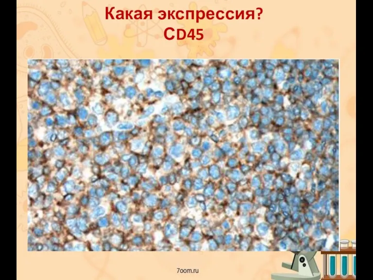 Какая экспрессия? СD45