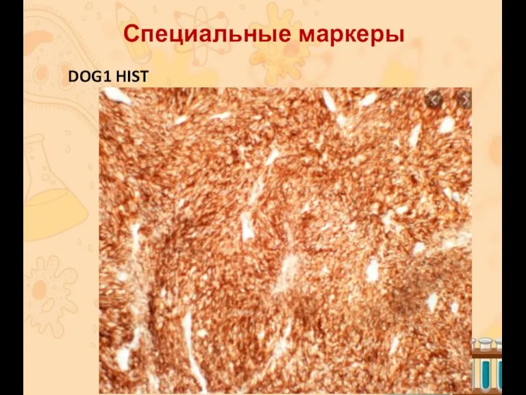 Специальные маркеры DOG1 HIST