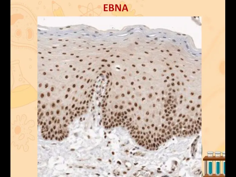 EBNA