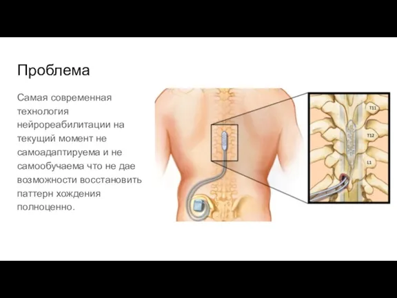 Проблема Самая современная технология нейрореабилитации на текущий момент не самоадаптируема и не