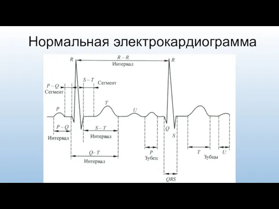 Нормальная электрокардиограмма