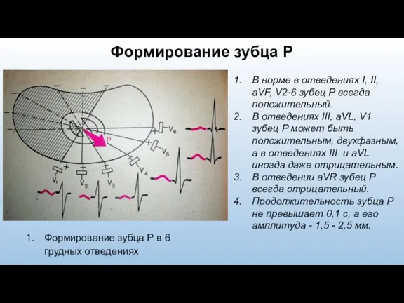 Формирование зубца Р Формирование зубца Р в 6 грудных отведениях В норме