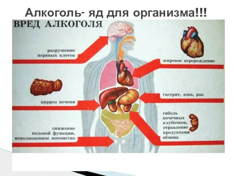 Алкоголь- яд для организма!!!