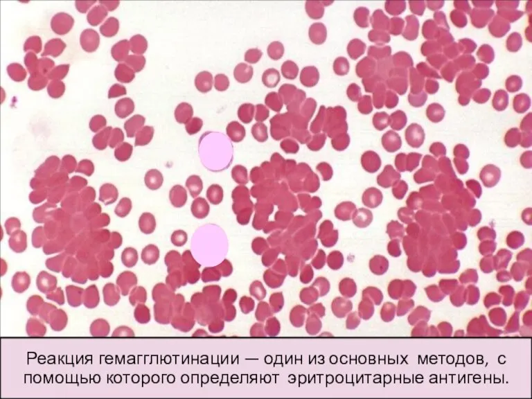 Реакция гемагглютинации — один из основных методов, с помощью которого определяют эритроцитарные антигены.