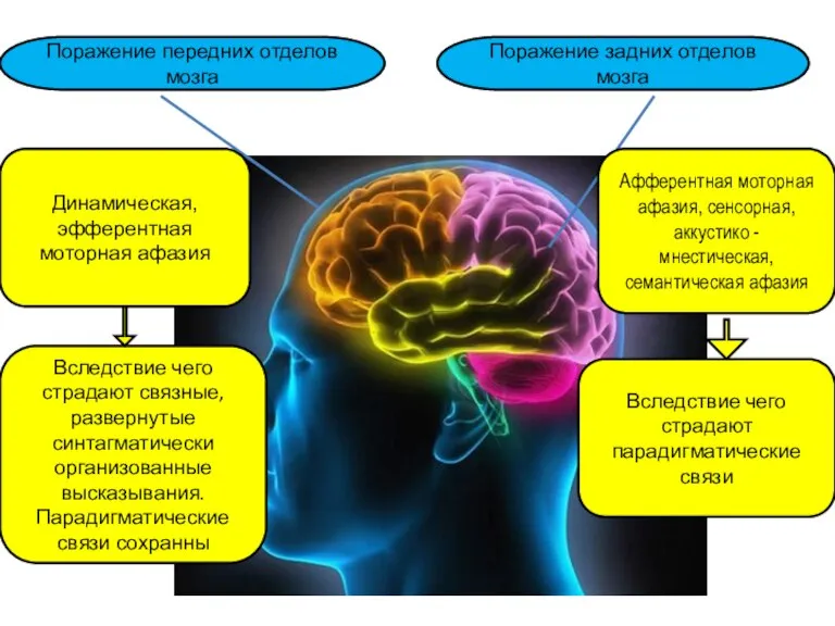 Афферентная моторная афазия, сенсорная, аккустико - мнестическая, семантическая афазия Динамическая, эфферентная моторная