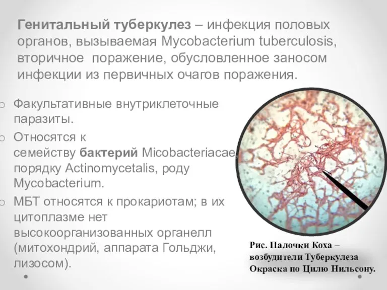 Генитальный туберкулез – инфекция половых органов, вызываемая Mycobacterium tuberculosis, вторичное поражение, обусловленное