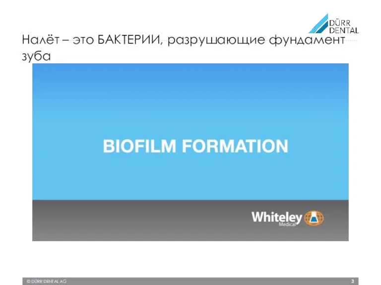 © DÜRR DENTAL AG Налёт – это БАКТЕРИИ, разрушающие фундамент зуба