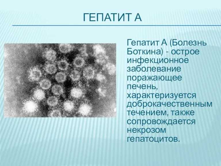 ГЕПАТИТ А Гепатит А (Болезнь Боткина) - острое инфекционное заболевание поражающее печень,