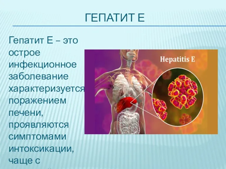 ГЕПАТИТ Е Гепатит Е – это острое инфекционное заболевание характеризуется поражением печени,