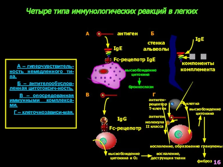 Четыре типа иммунологических реакций в легких А – гиперчувствитель-ность немедленного ти-па. Б