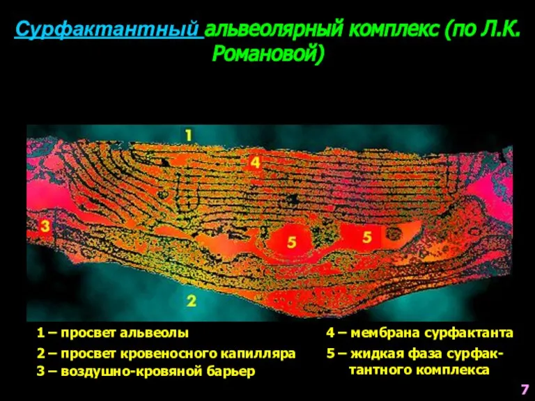 Сурфактантный альвеолярный комплекс (по Л.К.Романовой) 1 – просвет альвеолы 2 – просвет