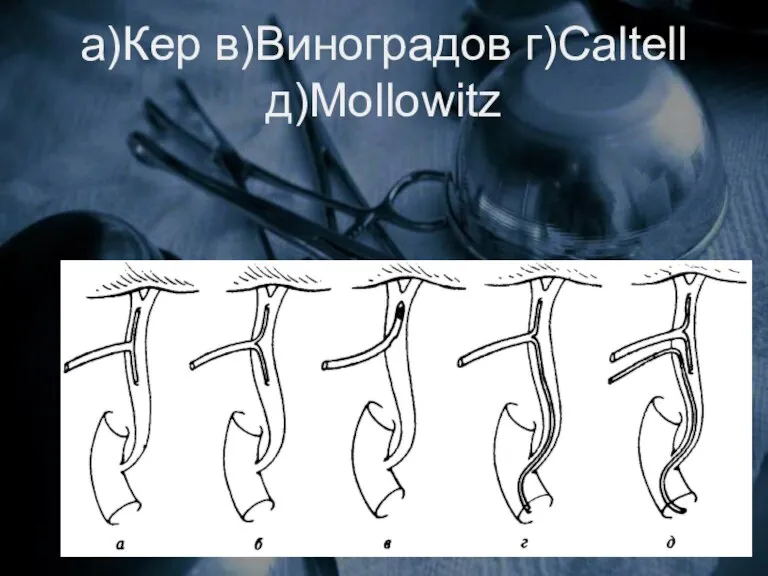 а)Кер в)Виноградов г)Caltell д)Mollowitz