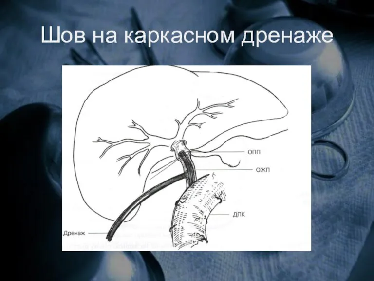 Шов на каркасном дренаже