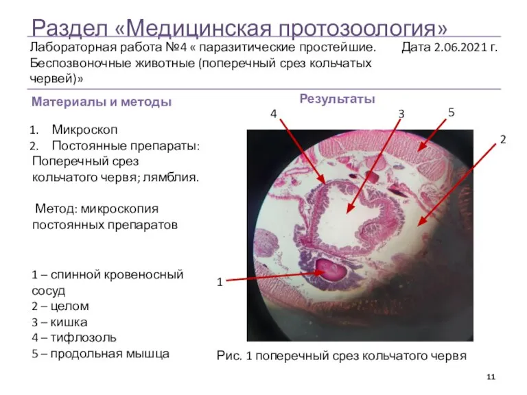 Раздел «Медицинская протозоология» Материалы и методы Результаты Микроскоп Постоянные препараты: Поперечный срез