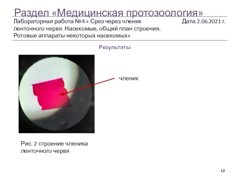 Раздел «Медицинская протозоология» Результаты Рис. 2 строение членика ленточного червя членик