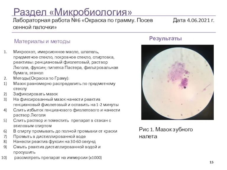 Раздел «Микробиология» Результаты Материалы и методы Микроскоп, имерсионное масло, шпатель, предметное стекло,