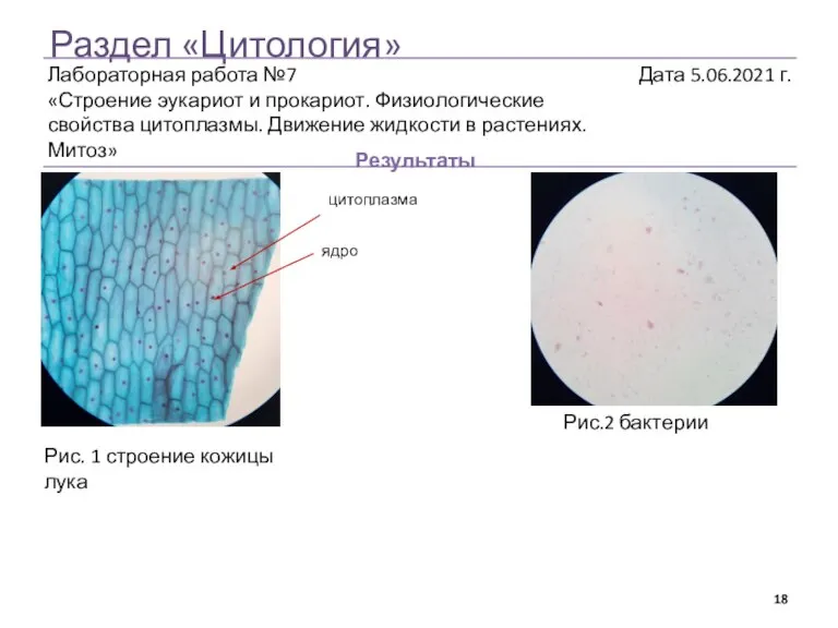 Раздел «Цитология» Результаты Рис. 1 строение кожицы лука ядро цитоплазма Рис.2 бактерии
