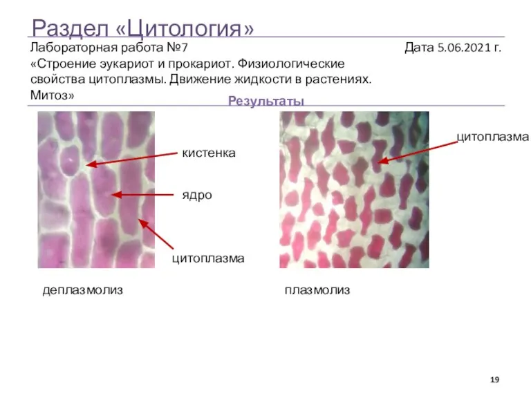 Раздел «Цитология» Результаты деплазмолиз плазмолиз цитоплазма ядро кистенка цитоплазма