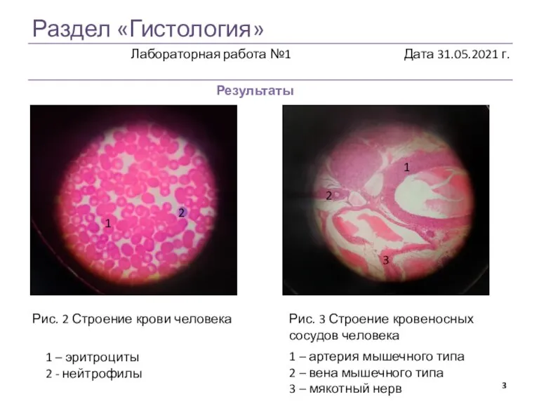 Раздел «Гистология» Результаты Рис. 2 Строение крови человека Рис. 3 Строение кровеносных