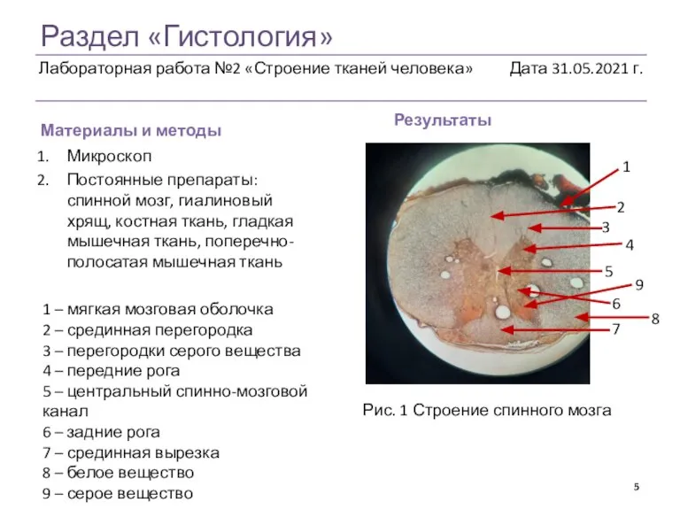 Раздел «Гистология» Материалы и методы Результаты Микроскоп Постоянные препараты: спинной мозг, гиалиновый