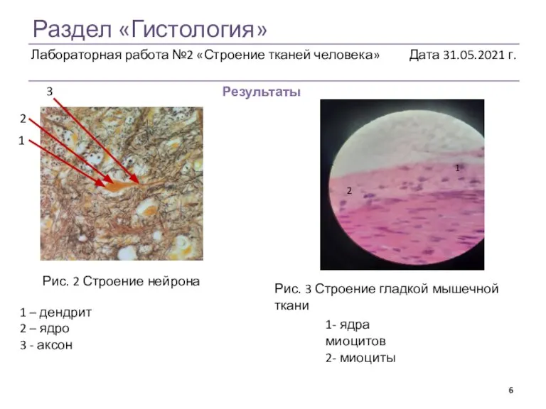 Раздел «Гистология» Результаты Рис. 2 Строение нейрона Рис. 3 Строение гладкой мышечной