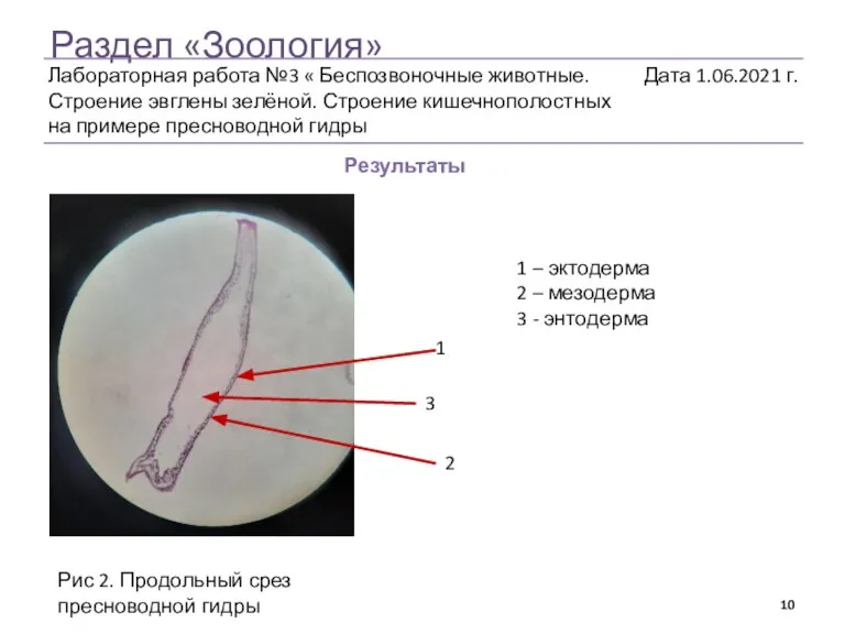 Раздел «Зоология» Результаты 1 2 3 1 – эктодерма 2 – мезодерма