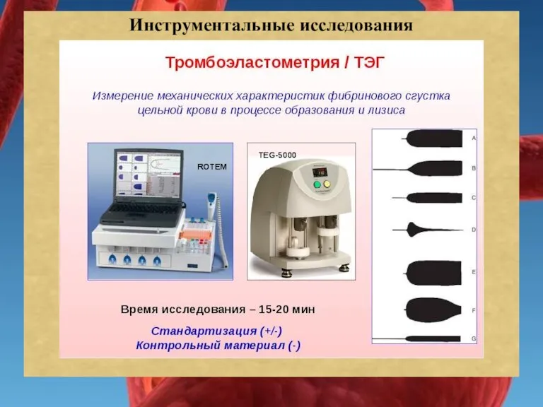 Инструментальные исследования