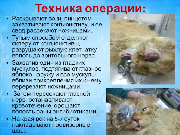 Техника операции: Раскрывают веки, пинцетом захватывают конъюнктиву, и ее свод рассекают ножницами.