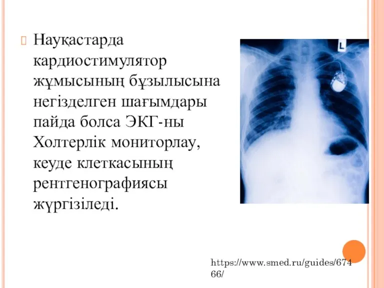 Науқастарда кардиостимулятор жұмысының бұзылысына негізделген шағымдары пайда болса ЭКГ-ны Холтерлік мониторлау, кеуде клеткасының рентгенографиясы жүргізіледі. https://www.smed.ru/guides/67466/