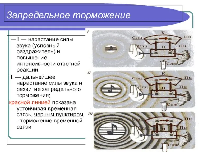 Запредельное торможение I—II — нарастание силы звука (условный раздражитель) и повышение интенсивности