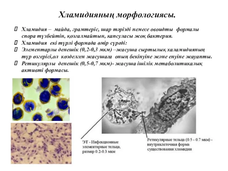 Хламидияның морфологиясы. Хламидия – майда, грамтеріс, шар тәрізді немесе овоидты формалы спора