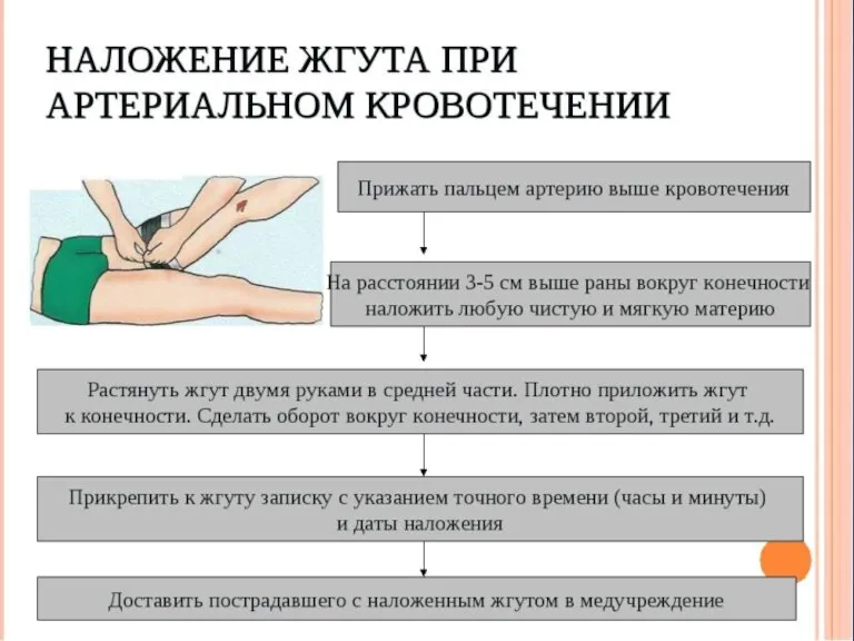 Правила наложения жгута