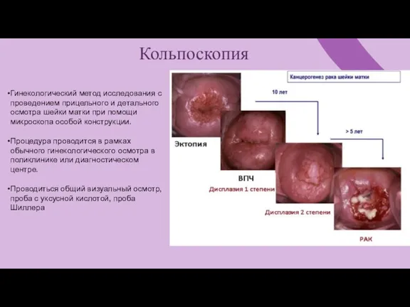 Кольпоскопия Гинекологический метод исследования с проведением прицельного и детального осмотра шейки матки