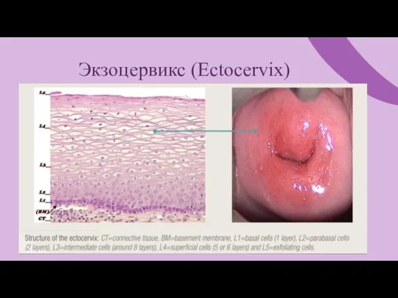 Экзоцервикс (Ectocervix)