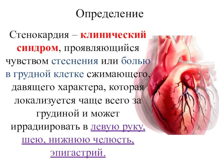 Определение Стенокардия – клинический синдром, проявляющийся чувством стеснения или болью в грудной