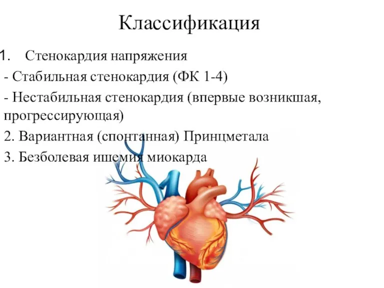 Классификация Стенокардия напряжения - Стабильная стенокардия (ФК 1-4) - Нестабильная стенокардия (впервые