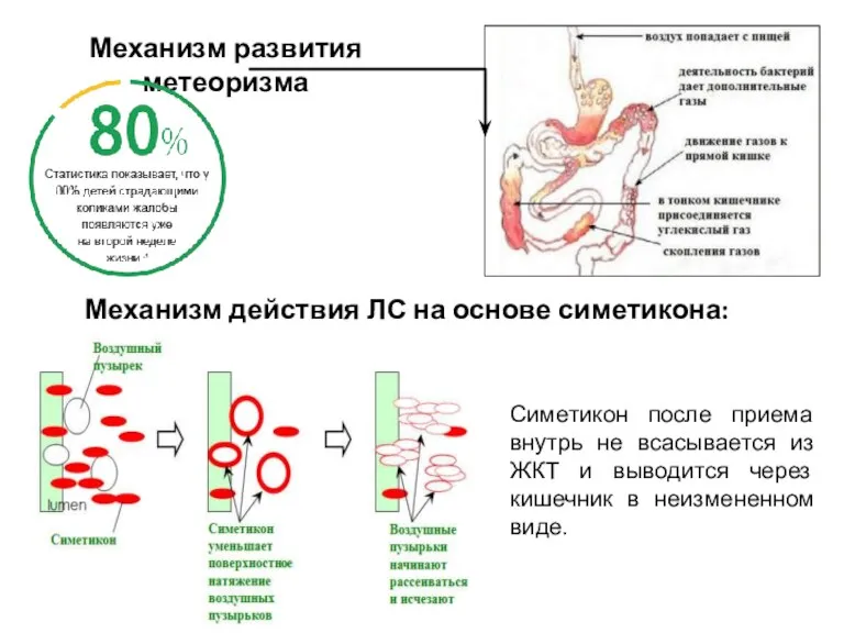 Механизм развития метеоризма Механизм действия ЛС на основе симетикона: Симетикон после приема