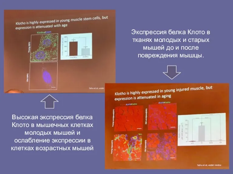 Экспрессия белка Клото в тканях молодых и старых мышей до и после